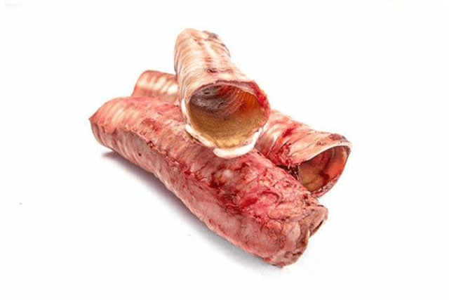 Trachea